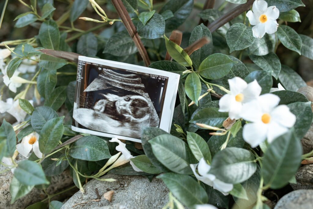 Ultrasound photo resting among white flowers and green leaves at Discovery Garden in Roseburg, Oregon during a maternity photography session.